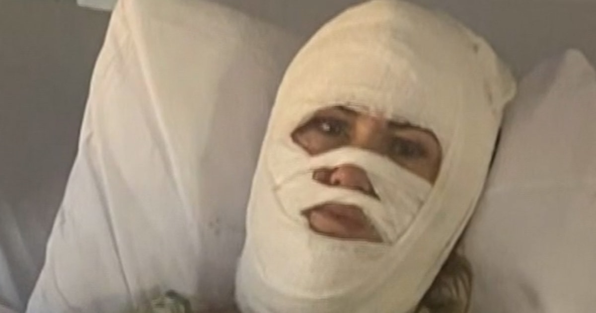 Suspect sought in acid attack on Georgia woman