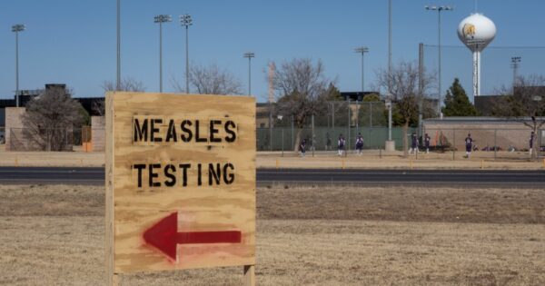 After a year of measles outbreaks, is the virus endemic in U.S.?