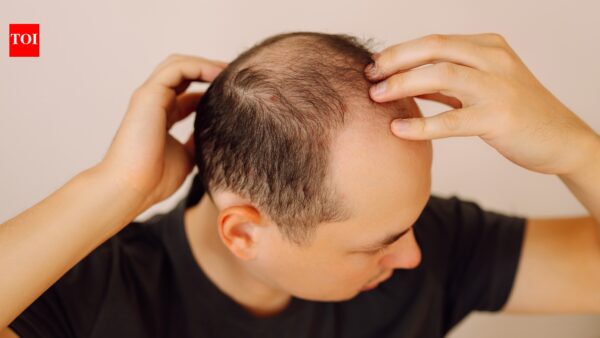 Scientists develop plant-based serum that regrows hair within weeks |