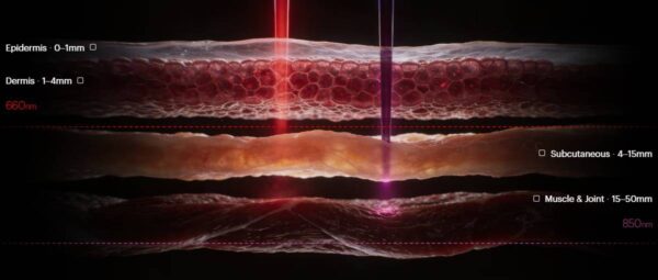 Ultrahuman unveils Photon – a $249 red light therapy device that is now on pre-order
