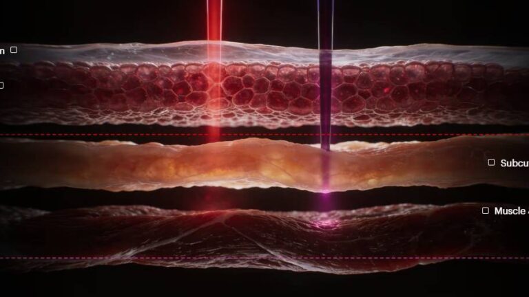 Ultrahuman unveils Photon – a $249 red light therapy device that is now on pre-order